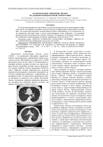 Распознавание эмфиземы лёгких по данным компьютерной томографии
