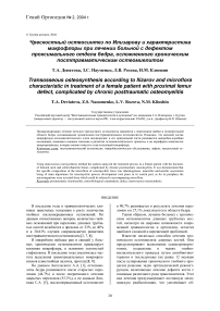 Чрескостный остеосинтез по Илизарову и характеристика микрофлоры при лечении больной с дефектом проксимального отдела бедра, осложненного хроническим посттравматическим остеомиелитом