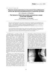 Перелом межмыщелкового возвышения большеберцовой кости как причина нестабильности в коленном суставе