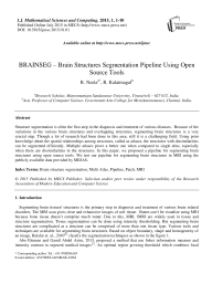 BRAINSEG – Brain Structures Segmentation Pipeline Using Open Source Tools