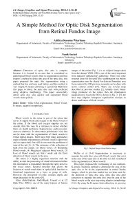 A Simple Method for Optic Disk Segmentation from Retinal Fundus Image