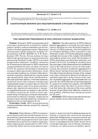 Лабораторный феномен ЭДТА-индуцированной агрегации тромбоцитов