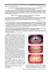 Ортодонтическая помощь в комплексном лечении пациентов с выраженной патологией пародонта