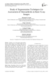 Study of segmentation techniques for assessment of osteoarthritis in knee X-ray images